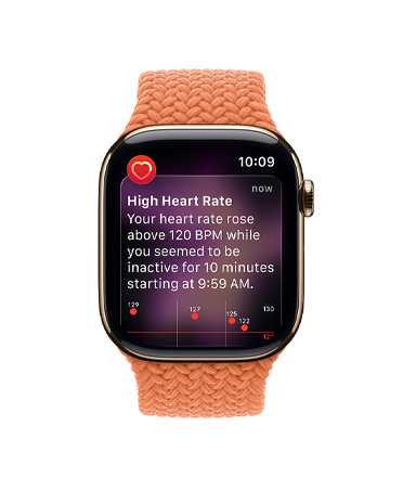 Apple Watch Series 11, титанов корпус, в златно, известяване за висока сърдечна честота, Braided Solo Loop, цвят куркума